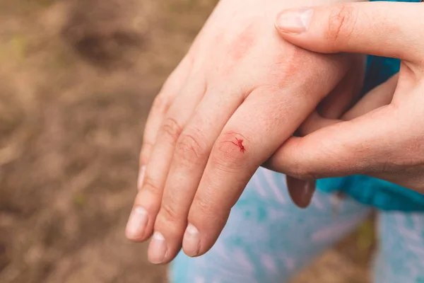 Dedo na mão humana direita é cortado ferido e sangramento com sangue vermelho brilhante — Fotografia de Stock