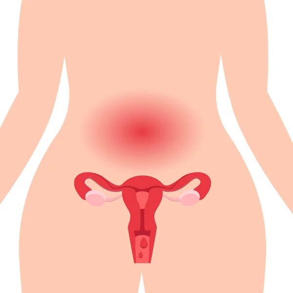 Lékařský ilustrační koncept zdravé reprodukční soustavy žen s dělohy a vaječníky. — Stockový vektor