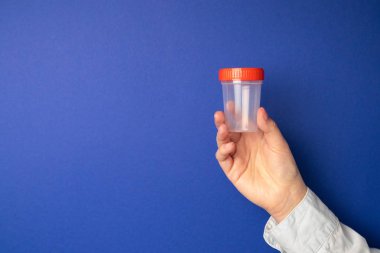 Kanser hücrelerinin test tıbbi kavramı. Patolojik test sürahi.