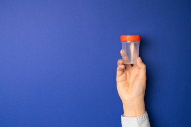 Doktor tıbbi analiz için sperm ile plastik bir kap tutan.