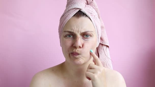 De strijd tegen acne. Probleem huid. Het meisje is ongelukkig met de conditie van haar huid. — Stockvideo