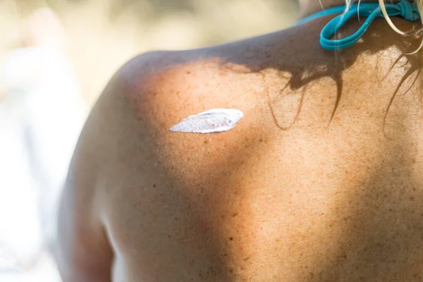 Sunscreen white cream or lotion on the shoulder of the human body. UV protection of human skin, skin cancer