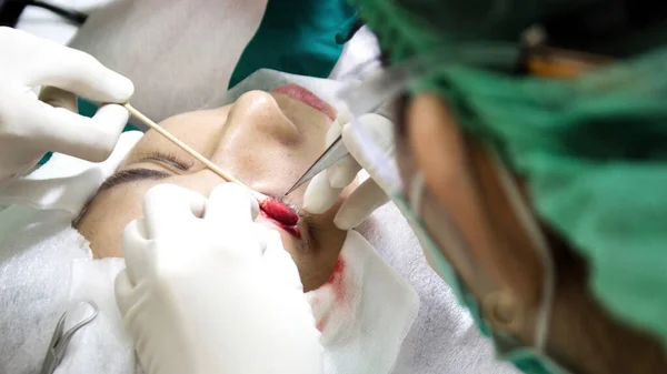 Close Χειρουργική Διαδικασία Βλεφάρου Στην Ομορφιά Και Την Ιατρική Βιομηχανία — Φωτογραφία Αρχείου