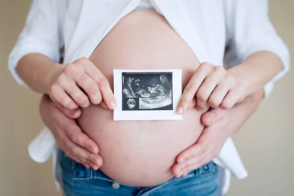 Mujer Embarazada Con Marido Sosteniendo Ecografía Concepto Atención Salud Del — Foto de Stock