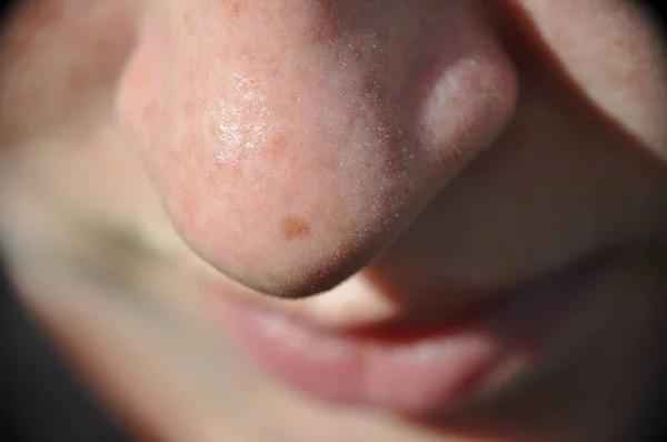 Macro nariz close-up da mulher menina com uma única sarda e cabelo Vellus. — Fotografia de Stock