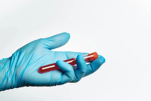Hand with blue glove holding a test tube