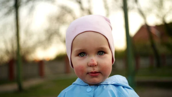 Zdenerwowana Dziewczynka Niebieskim Kombinezonie Zadrapaniami Nosie Dziecko Już Nie Płacze — Zdjęcie stockowe
