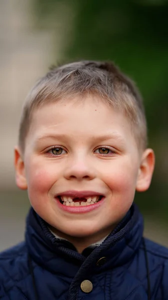 Retrato Rapaz Com Dentes Frente Caídos Bebê Mostra Lacuna Entre — Fotografia de Stock