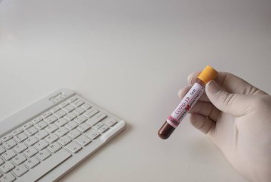 covid 19 kan testi ve beyaz zemin üzerinde pozitif bilgisayar klavyesi testi