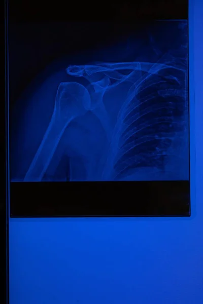 Doctor Ray Right Shoulder — Stock Photo, Image