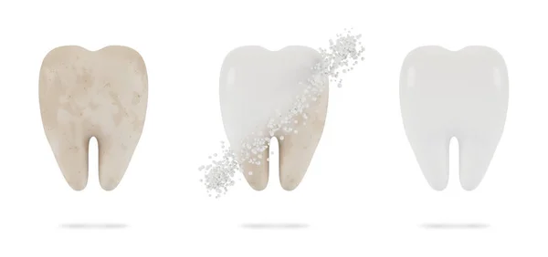 Tandblekning Begreppet Tandundersökning Tänder Tandhälsa Och Hygien Illustration — Stockfoto