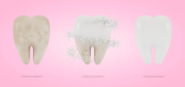 Tooth whitening. The concept of dental examination of teeth, dental health and hygiene. 3D illustration.