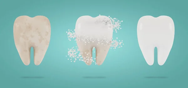 Branqueamento Dos Dentes Conceito Exame Dentário Dos Dentes Saúde Dentária — Fotografia de Stock