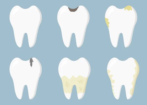 Enfermedades Dentales Caries Dental Inflamación Placa Dental Enfermedad Periodontal Concepto — Vector de stock