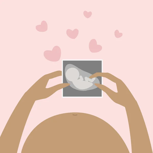 Bir Kadın Elinde Çocuğunun Ultrason Fotoğrafını Tutuyor Hamile Bir Kadının — Stok Vektör