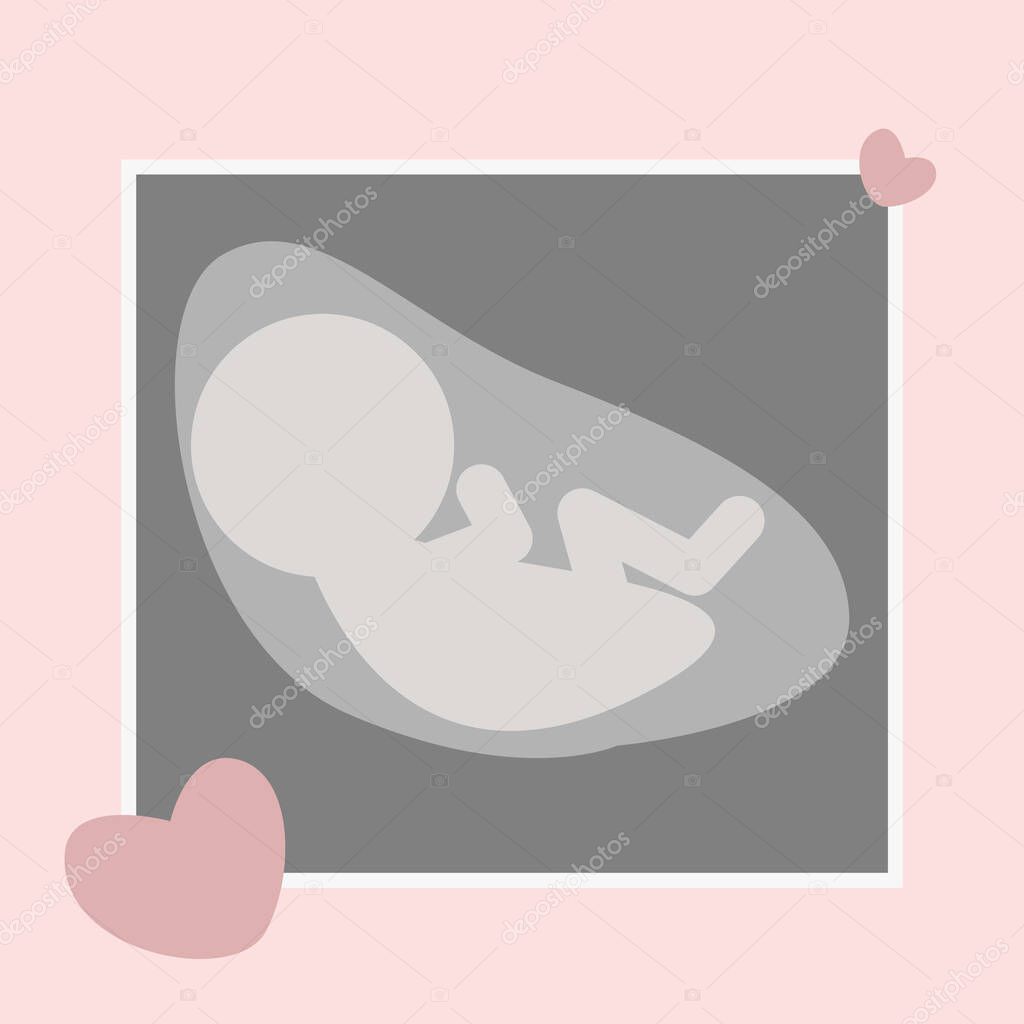 Vector illustration of an ultrasound scan of the unborn child.