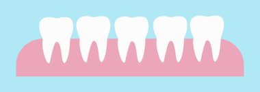 Diş eti vektör llütasyonunda 5 sağlıklı diş. Diş beyazlatmanın sonucu.