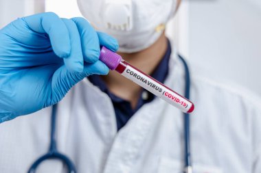 Coronavirus (COVID-19) için hastaların kan örneklerini test eden doktor, içinde koronavirüs pozitif veya negatif bir kan örneği bulunmayan bir test tüpü tutar..