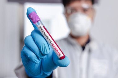 Coronavirus (COVID-19) için hastaların kan örneklerini test eden doktor, içinde koronavirüs pozitif veya negatif bir kan örneği bulunmayan bir test tüpü tutar..