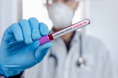 Coronavirus (COVID-19) için hastaların kan örneklerini test eden doktor, içinde koronavirüs pozitif veya negatif bir kan örneği bulunmayan bir test tüpü tutar..
