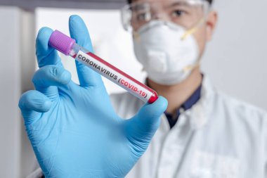 Coronavirus (COVID-19) için hastaların kan örneklerini test eden doktor, içinde koronavirüs pozitif veya negatif bir kan örneği bulunmayan bir test tüpü tutar..