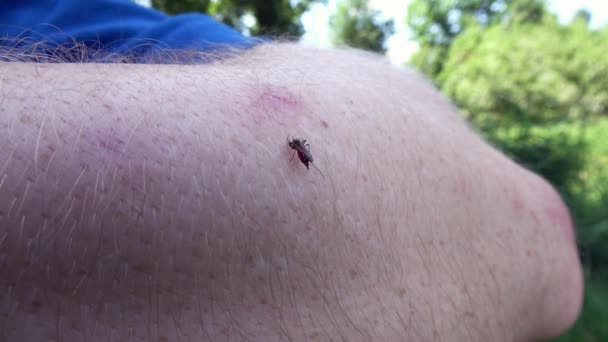 Sangue Mosquito Chupando Pele Humana — Vídeo de Stock