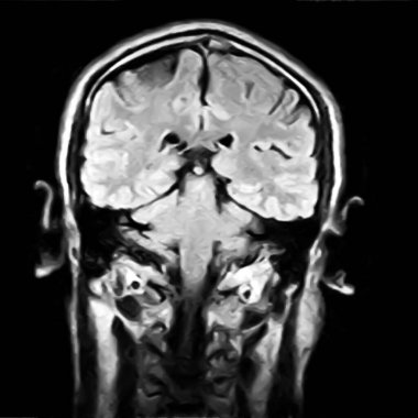 Kafatasının nükleer manyetik rezonans görüntüsü