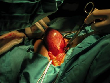 Genel cerrahi ameliyathanede.