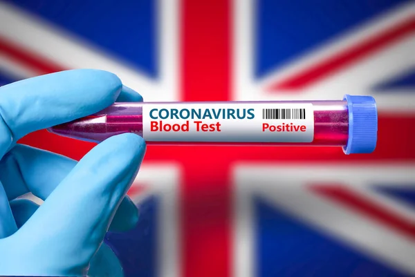 Büyük Britanya bayrağının arka planına karşı koronavirüs için pozitif bir test tüpü. Büyük Britanya 'daki koronavirüs salgınıyla savaşmak için COVID-19 kavramı