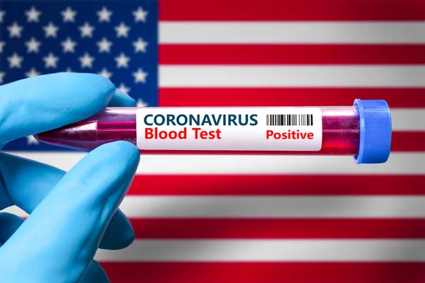 A test tube with a positive test for coronavirus against the background of the flag of United States of America. COVID-19 concept for fighting the coronavirus epidemic in United States of America