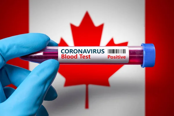A test tube with a positive test for coronavirus against the background of the flag of Canada. COVID-19 concept for fighting the coronavirus epidemic in  Canada