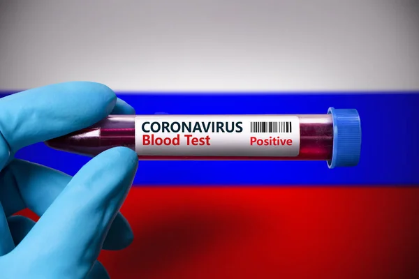 Rusya bayrağının arka planına karşı koronavirüs için pozitif bir test tüpü. Rusya 'daki koronavirüs salgınıyla mücadele için COVID-19 kavramı 