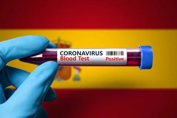 İspanya 'da Coronavirüs salgınıyla mücadele için .Spain COVID-19 bayrağının arka planına karşı koronavirüs testi pozitif olan bir test tüpü.