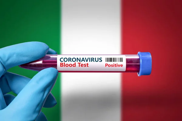A test tube with a positive test for coronavirus against the background of the flag of Italy. COVID-19 concept for fighting the coronavirus epidemic in  Italy