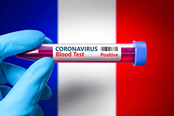 A test tube with a positive test for coronavirus against the background of the flag of. France COVID-19 concept for fighting the coronavirus epidemic in France