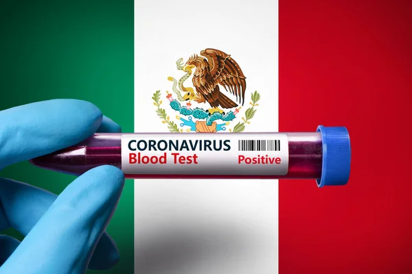 A test tube with a positive test for coronavirus against the background of the flag of Australia. COVID-19 concept for fighting the coronavirus epidemic in  Australia