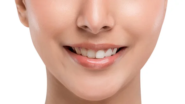 Close Teeth Problem Young Attractive Caucasian Woman Smiling Isolated White — Stock Photo, Image