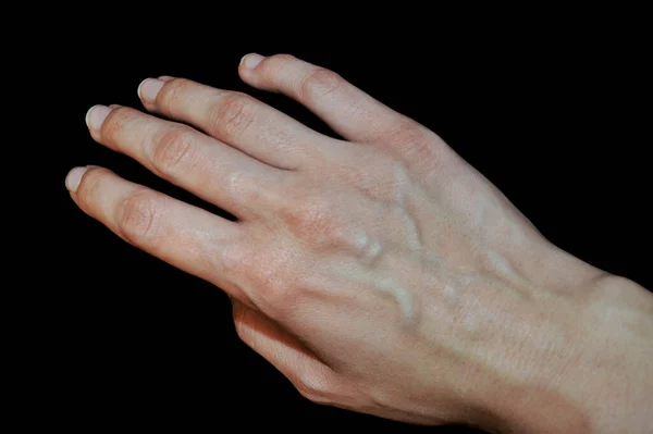 Vrouw Handen Met Bloedvaten Emotioneel Gebaar — Stockfoto