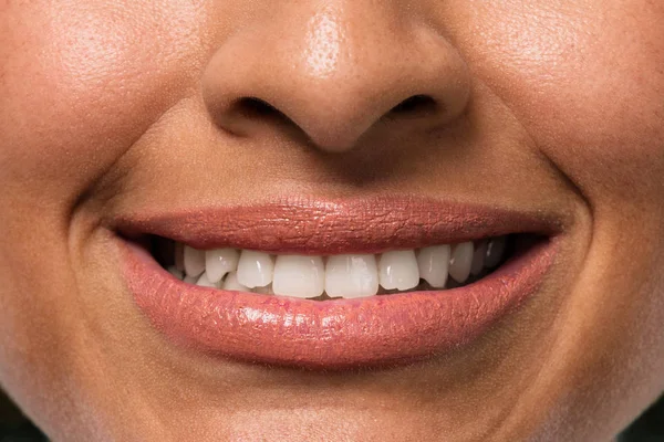 Αφρο Γυναίκα Δόντια Κινηματογράφηση Πρώτο Πλάνο — Φωτογραφία Αρχείου