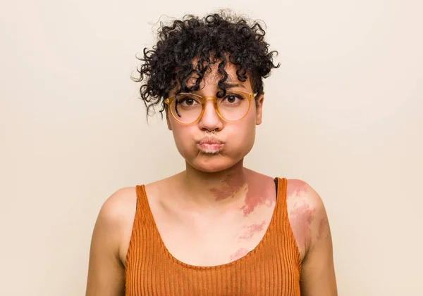 Young african american woman with skin birth mark blows cheeks, has tired expression. Facial expression concept.