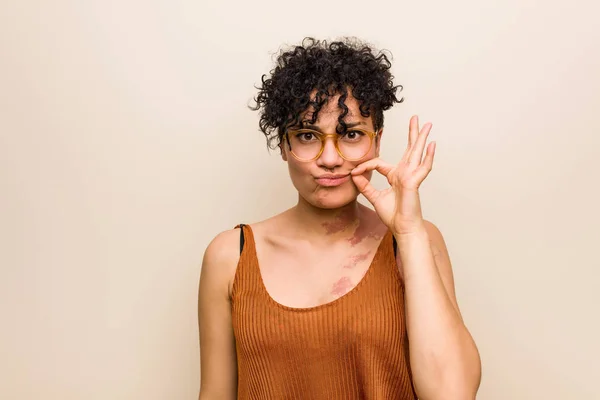 Mujer Afroamericana Joven Con Marca Nacimiento Piel Con Los Dedos —  Fotos de Stock