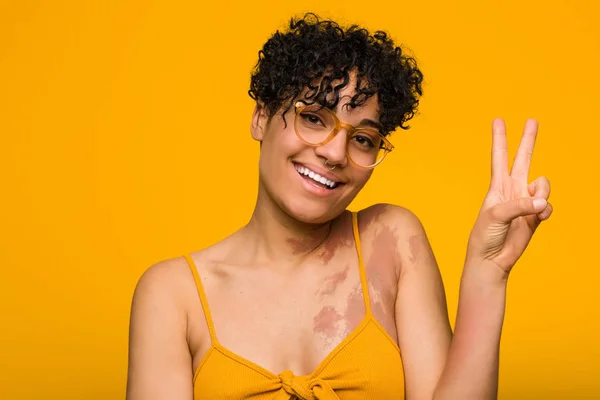 Young african american woman with skin birth mark joyful and carefree showing a peace symbol with fingers.