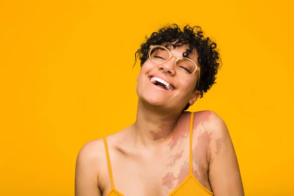 Młoda Afroamerykanka Znamieniem Skóry Zrelaksowany Szczęśliwy Śmiech Rozciągnięty Kark Pokazując — Zdjęcie stockowe