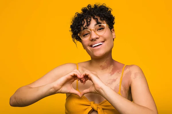 Jong Afrikaans Amerikaans Vrouw Met Huid Geboorte Merk Glimlachen Tonen — Stockfoto