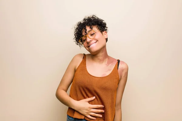 Mujer Afroamericana Joven Con Marca Nacimiento Piel Toca Barriga Sonríe —  Fotos de Stock
