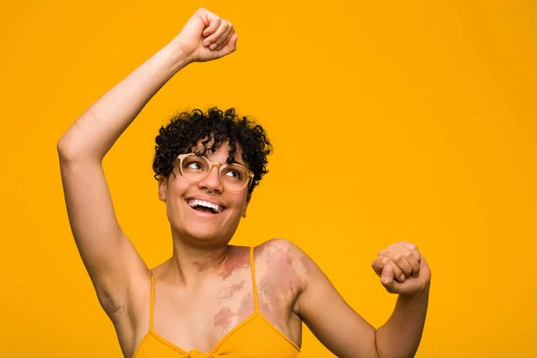 Young african american woman with skin birth mark celebrating a special day, jumps and raise arms with energy.