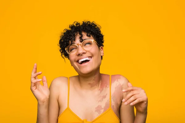 Młoda Afroamerykanka Znamieniem Skóry Dużo Się Śmieje Koncepcja Szczęścia — Zdjęcie stockowe