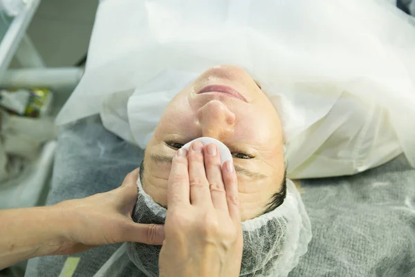 Ein Besuch Bei Der Kosmetikerin Verfahren Carboxytherapie Der Arzt Entfernt — Stockfoto