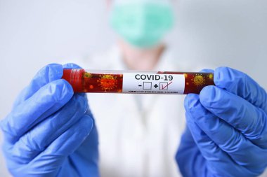 COVID-19 salgını. Doktor elinde Coronavirüs enfeksiyonu olan kan örneği tutuyor.. 