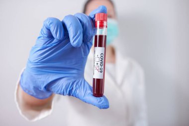 Doktor Coronavirus virüsü bulaşmış, maske ve eldiven takmış pozitif ve negatif kan örneği tutuyor. Salgın COVID-19
